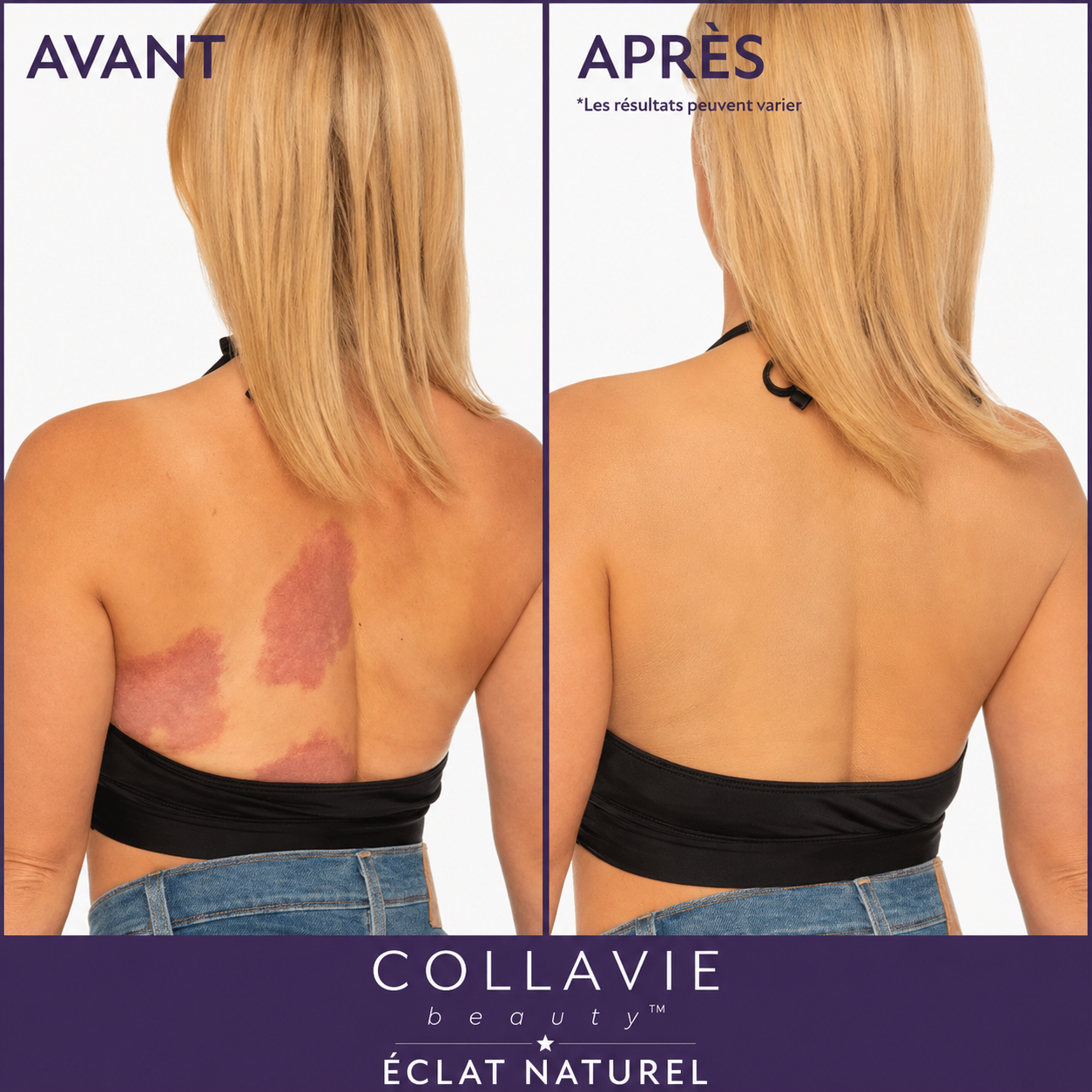 Maquillage Corporel Haute Couvrance COLLAVIE